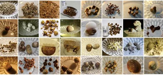 胆结石患者注意!这3个关键时机一错过,胆囊可能就保不住了【四川胆结石专科医院】(图2) 胆结石患者注意!这3个关键时机一错过,胆囊可能就保不住了【四川胆结石专科医院】(图2)