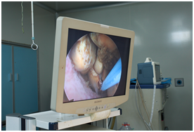 胆结石小≠小事情?轻视胆结石,后果远比你想象的严重【四川胆结石专科医院】(图5) 胆结石小≠小事情?轻视胆结石,后果远比你想象的严重【四川胆结石专科医院】(图5)