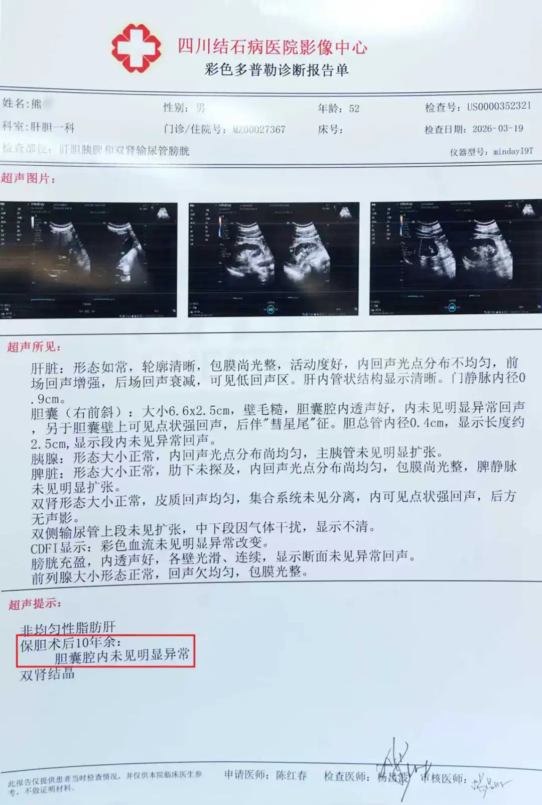 保胆10年,胆囊依旧完好!52岁患者亲身见证:保胆真的靠谱!(图1) 保胆10年,胆囊依旧完好!52岁患者亲身见证:保胆真的靠谱!(图1)