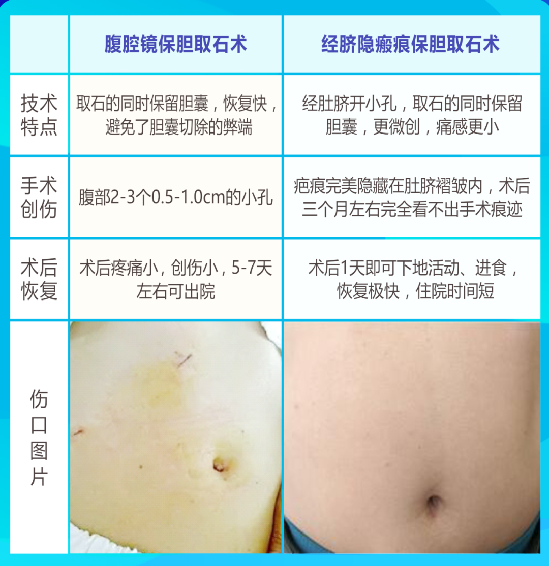 胆囊切除有危害吗?来听听肝胆专家怎么说【成都胆结石专科医院】(图4) 胆囊切除有危害吗?来听听肝胆专家怎么说【成都胆结石专科医院】(图4)