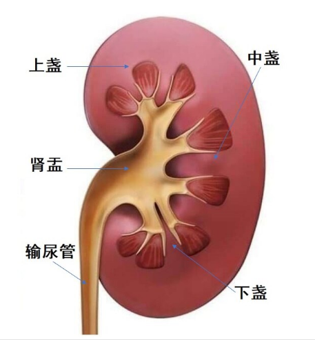 体检查出肾结石,别慌!先搞懂这3件事,少走弯路不遭罪【四川结石病医院】(图3) 体检查出肾结石,别慌!先搞懂这3件事,少走弯路不遭罪【四川结石病医院】(图3)